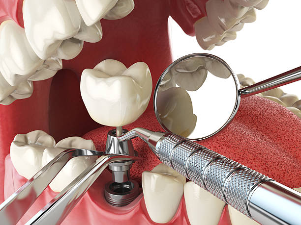 Best Emergency Tooth Extraction  in Huber Heights, OH